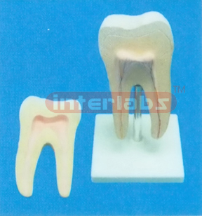 MIDDLE HEALTH MOLAR, WITH STAND (2 Parts) 16.8 cm LONG